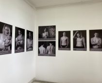 Izložbom fotografija Udruženje pacijenta ukazalo na značaj brige o sopstvenoj koži